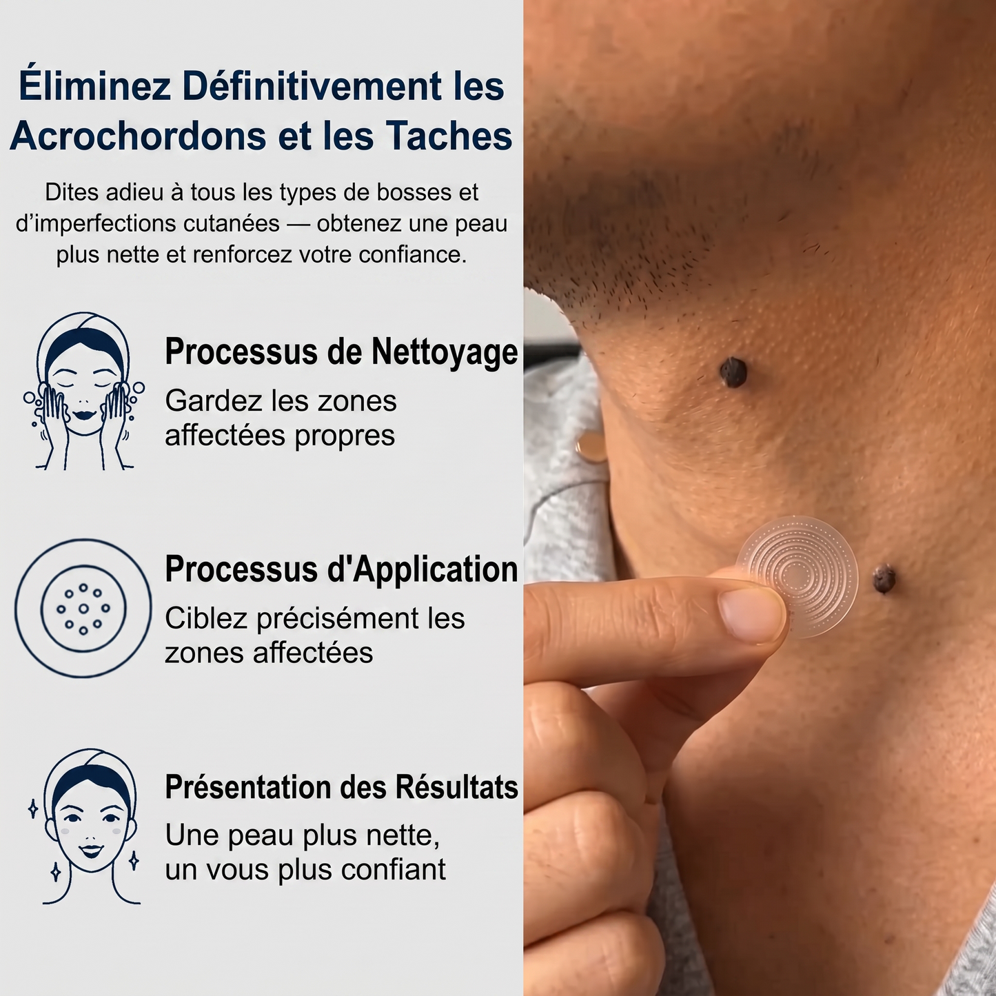 【🔥 Dernier jour : -70 % 🔥】🇫🇷 𝐇𝐞𝒂𝒍𝗿𝗶𝙯𝙚® Patch 2-en-1 à micro-aiguilles & hydrocolloïde | Aide à réduire l’apparence des grains de beauté, verrues, acné et étiquettes cutanées | Patchs invisibles visage & corps.