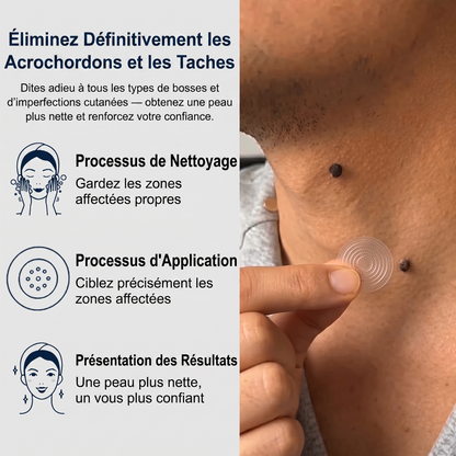 【🔥 Dernier jour : -70 % 🔥】🇫🇷 𝐇𝐞𝒂𝒍𝗿𝗶𝙯𝙚® Patch 2-en-1 à micro-aiguilles & hydrocolloïde | Aide à réduire l’apparence des grains de beauté, verrues, acné et étiquettes cutanées | Patchs invisibles visage & corps.